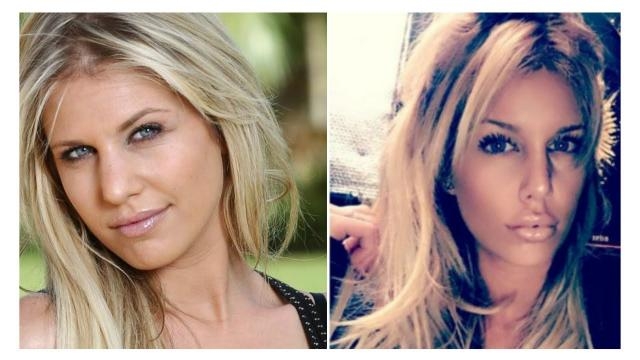 12 Candidates De Télé-réalité Avant Et Après La Chirurgie Esthétique Les stars de télé réalité avant et après chirurgie. Vous n'allez pas y