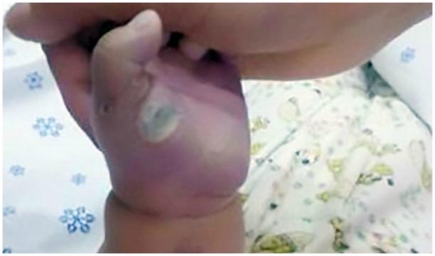 Bebê levou choque por mexer no carregador