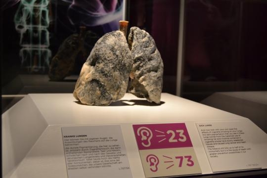 Real bodies raucherlunge plastiniert 691161