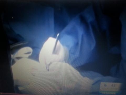  En acción: Cirugía de mano 