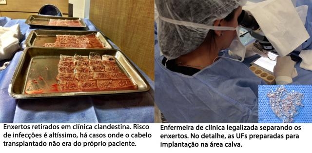 Risco de infecções é altíssimo