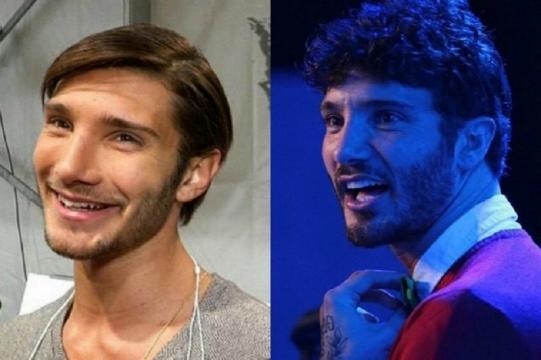 Stefano De Martino prima e dopo: interventino o no?
