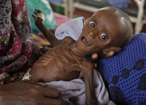 Un enfant en proie à la famine en Somalie