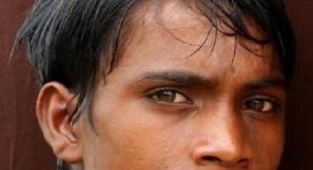 Discriminato e considerato dannato per la sua malformazione